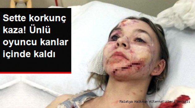 Sette Üzerine Cam Panel Düşen Kanadalı Oyuncu, Tanınmaz Halde